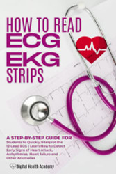 How to Read EKG/ECG Strips