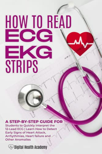 How to Read EKG/ECG Strips