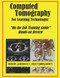 Computed Tomography For Learning Technologist