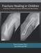 Fracture Healing in Children