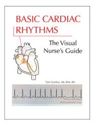 Basic Cardiac Rhythms: The Visual Nurse's Guide