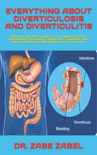 EVERYTHING ABOUT DIVERTICULOSIS AND DIVERTICULITIS