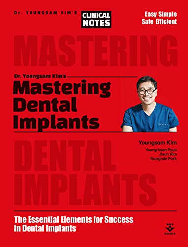 Mastering Dental Implants