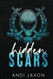 Hidden Scars: An MM Hockey Romance (Darby U Hockey Boys)