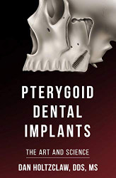 Pterygoid Implants: The Art and Science