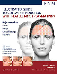 Illustrated Guide to Collagen Induction with Platelet-Rich Plasma