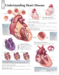 Understanding Heart Disease chart: Wall Chart