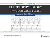 Essential Concepts of Electrophysiology through Case Studies