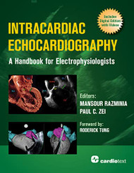 Intracardiac Echocardiography