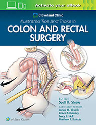 Cleveland Clinic Illustrated Tips and Tricks in Colon and Rectal