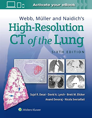 Webb Muller and Naidich's High-Resolution CT of the Lung
