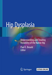 Hip Dysplasia: Understanding and Treating Instability of the Native