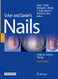 Scher and Daniel's Nails: Diagnosis Surgery Therapy