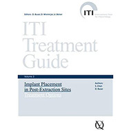 ITI Treatment Guide Volume 3