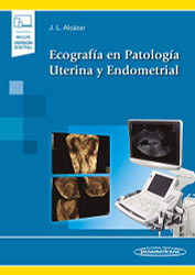 Ecografia en Patologia Uterina y Endometrial