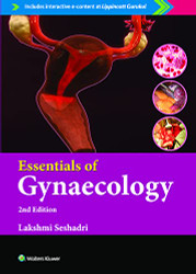 Essentials of Gynaecology
