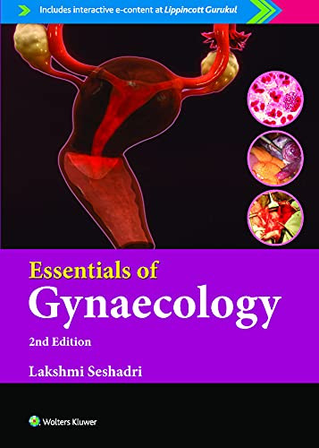 Essentials of Gynaecology