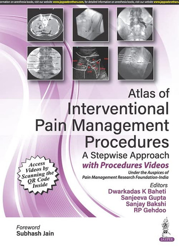 Atlas of Interventional Pain Management Procedures