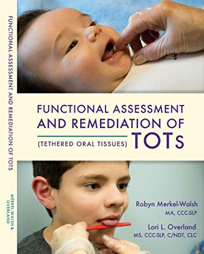 Tongue-Tied: Functional Assessment and Remediation of TOTs