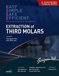 Extraction of Third Molars