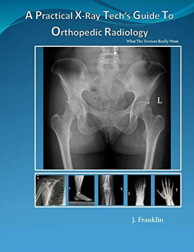 Practical X-Ray Tech's Guide To Orthopedic Radiology