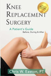 Knee Replacement Surgery A Patient's Guide