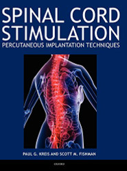 Spinal Cord Stimulation