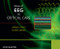 Hirsch and Brenner's Atlas of EEG in Critical Care