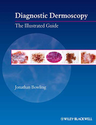 Diagnostic Dermoscopy