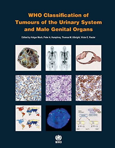 Urinary and Male Genital Tumours WHO Classification