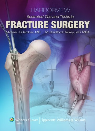 Harborview Illustrated Tips and Tricks In Fracture Surgery
