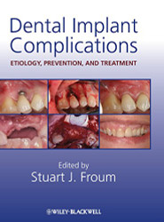 Dental Implant Complications