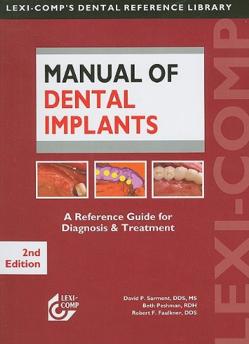 Lexi-Comp's Manual of Dental Implants
