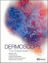 Dermoscopy the Essentials