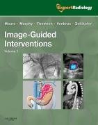 Image-Guided Interventions