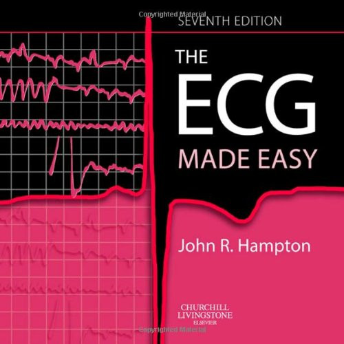 ECG Made Easy