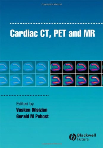 Cardiac CT PET and MR