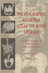 Photographic Regional Atlas of Bone Disease