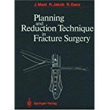 Planning and Reduction Technique In Fracture Surgery