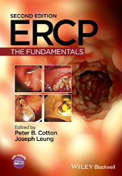 ERCP: The Fundamentals