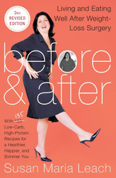 Before & After Second Revised Edition: Living and Eating Well After