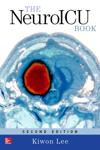 The NeuroICU Book