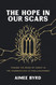 The Hope in Our Scars: Finding the Bride of Christ in the Underground