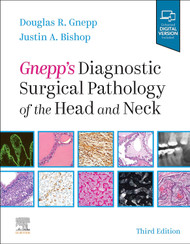 Gnepp's Diagnostic Surgical Pathology of the Head and Neck: Expert