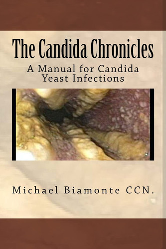 The Candida Chronicles: A Manual for Candida Yeast infections