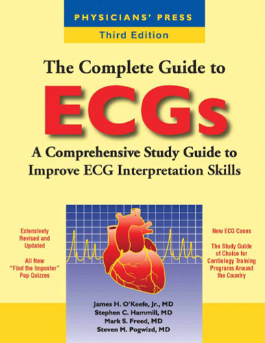 The Complete Guide to ECGs
