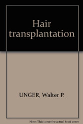 Hair transplantation
