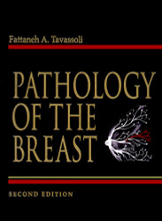 Pathology of The Breast