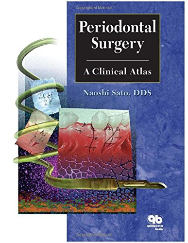 Periodontal Surgery: A Clinical Atlas