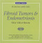 Fibroid Tumors and Endometriosis